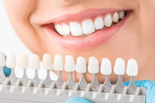 Teeth-Whitening-scaled-2-1